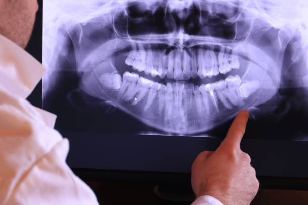 Best Emergency Treatment for Toothache in Nacogdoches, TX