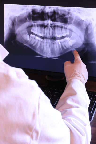 Best Emergency Wisdom Teeth Removal in Nacogdoches, TX