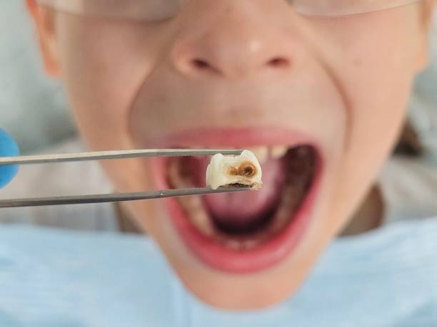 Best Pediatric Emergency Dentist in Nacogdoches, TX